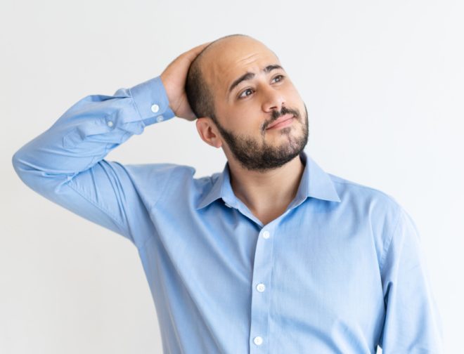 Foto de Calvicie masculina: cinco recomendaciones ante las primeras señales